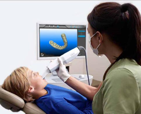 Digital Dental Impressions