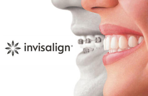 Is Invisalign for me?