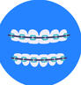 Braces